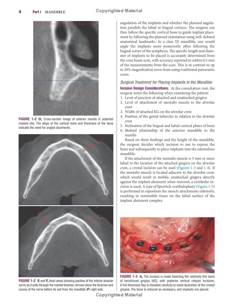 Color Atlas of Dental Implant Surgery - FAHASA.COM
