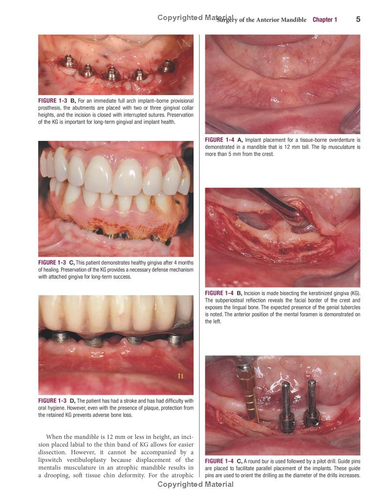 Color Atlas of Dental Implant Surgery - FAHASA.COM