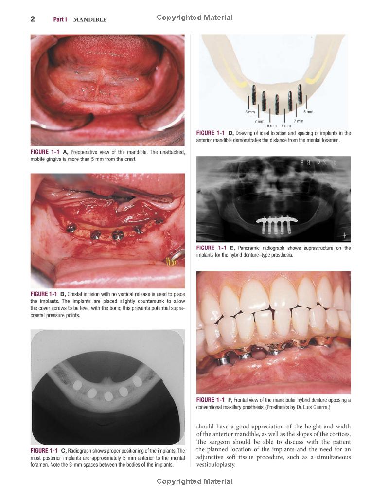 Color Atlas of Dental Implant Surgery - FAHASA.COM